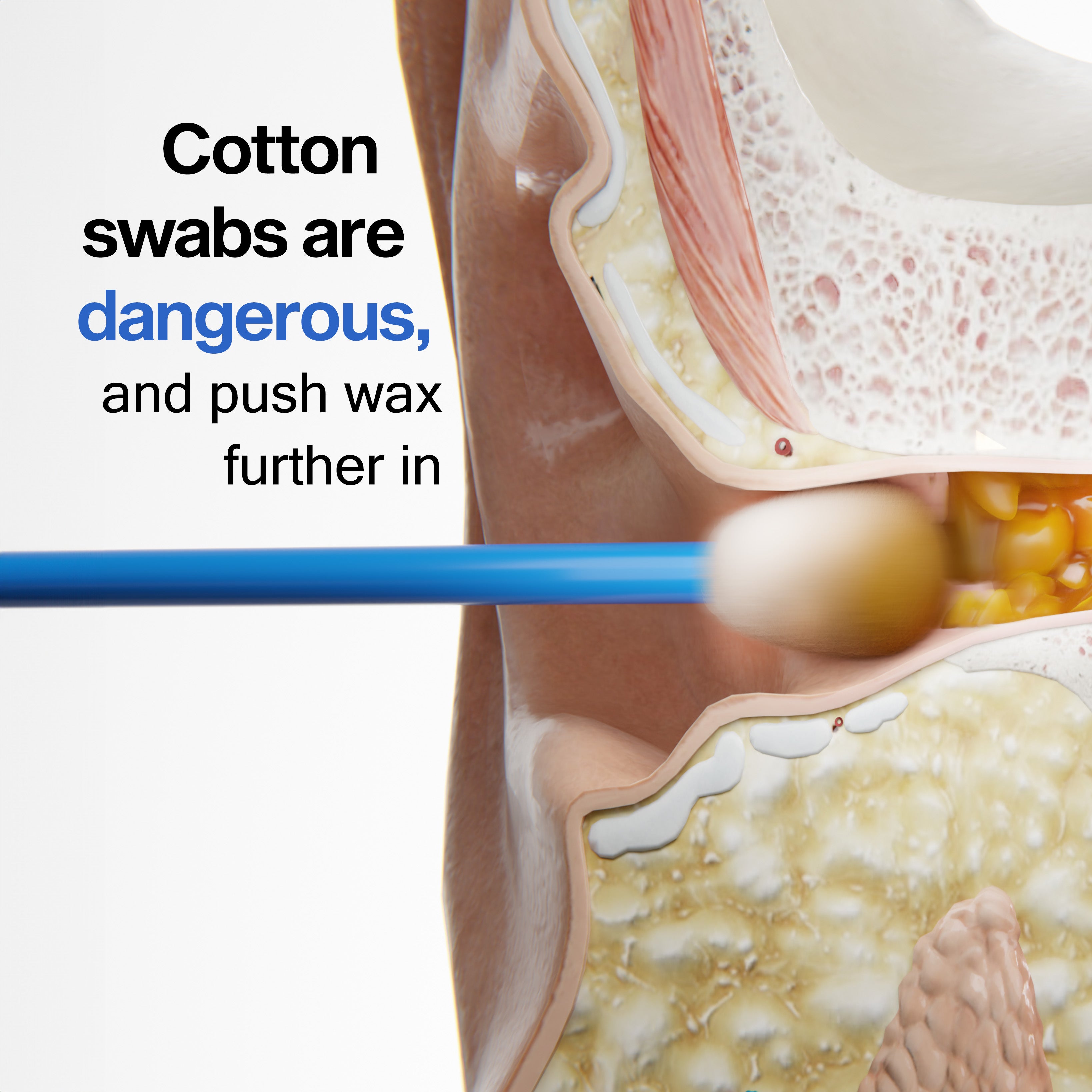 Flush Earwax Remover